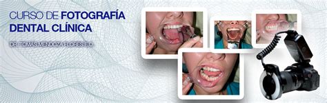 Curso De Fotograf A Dental Clinica Drd Diagn Stico D