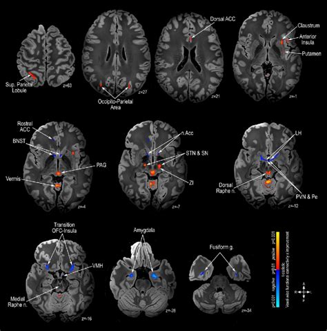 Functional Connectivity Mapping Magnetic Resonance Imaging Mri In Download Scientific