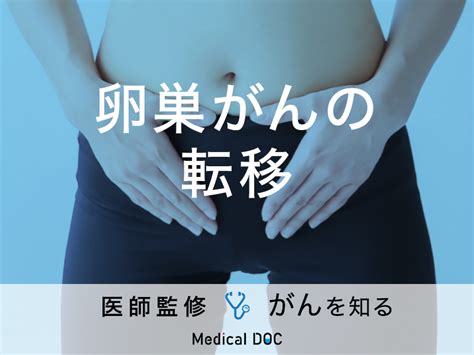 「卵巣がんが転移」するとどんな症状が出るの？転移しやすい部位も解説！ メディカルドック