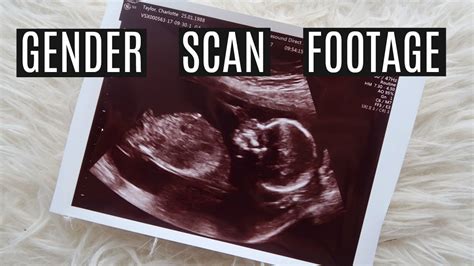 16 WEEK ULTRASOUND GENDER SCAN FOOTAGE FINDING OUT OUR BABY S