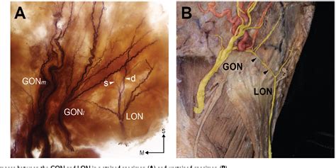 Structure of smaller occipital nerve | Semantic Scholar