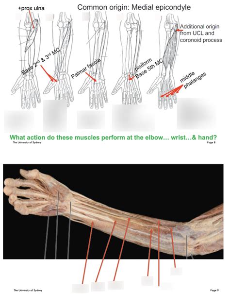 Superficial Extrinsic Muscles Of Anterior Forearm Diagram Quizlet