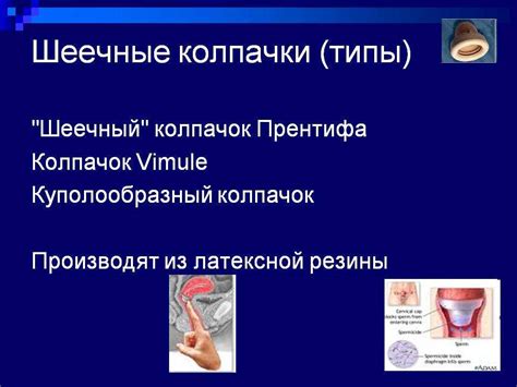 Цервикальный (шеечный) противозачаточный колпачок: как выбрать и ...