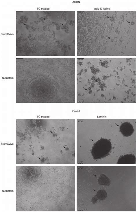 Morphology Of 3d Structures Formed By Caki 1 And Achn Cells In The Download Scientific Diagram