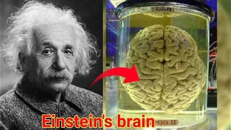 How Albert Einstein Brain Is Really Different Than Other Einstein