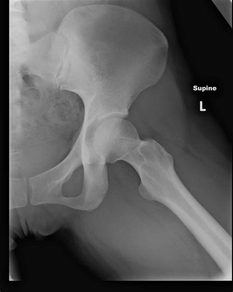 hips dont lie inspired physiotherapy