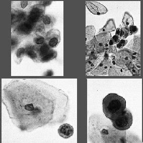 sample pap smear images  scientific diagram