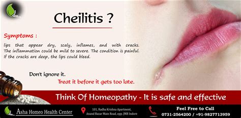 Understanding the Causes and Solutions for a Right-Side Lip Twitch 10