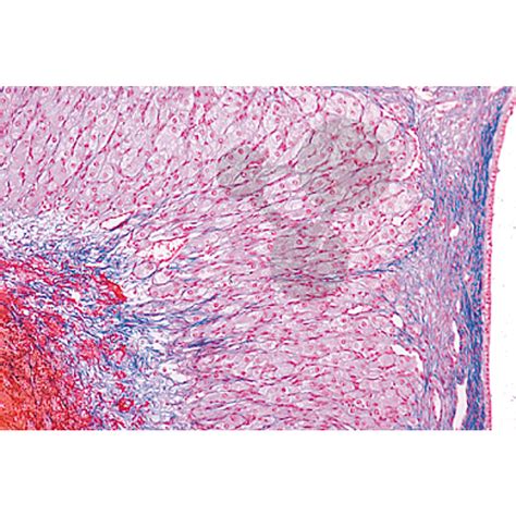 Série Histologie Organes génitaux femelles Préparations