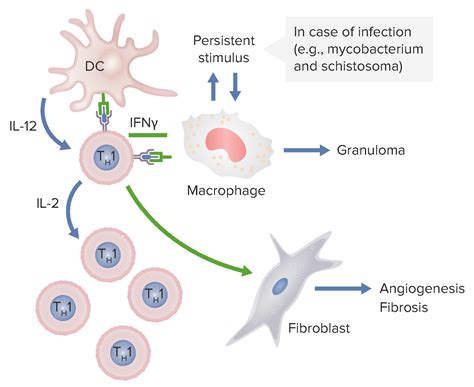 Type IV Hypersensitivity Reaction | Concise Medical Knowledge