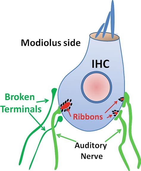 Is Hidden Hearing Loss Real Hears Hearing And Hearables