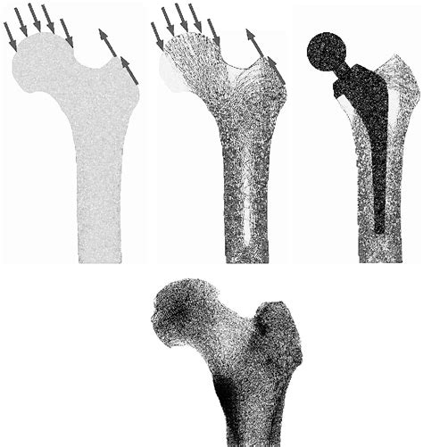 Figure 1 from Functional adaptation of bone as an optimal control problem | Semantic Scholar