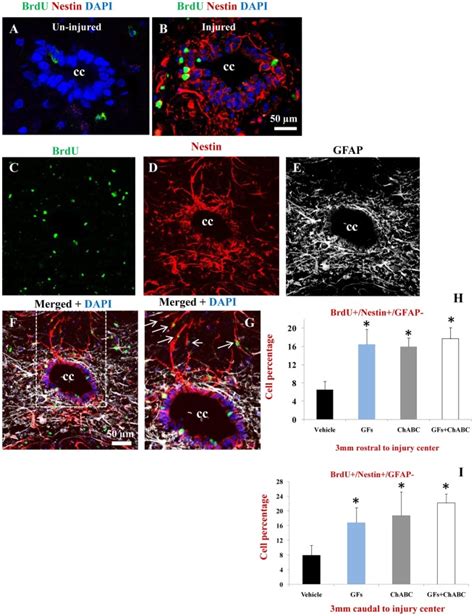 AB Confocal Images Showing Ependymal Region In The Central Canal