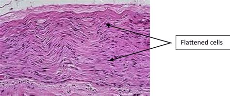 Histopathology Sample Seen Under The Microscope Revealing The Layers Of