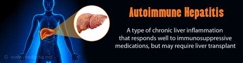 Autoimmune Hepatitis - Causes, Types, Symptoms, Complications, Diagnosis & Treatment