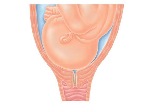 Diagram Of Cervix And Mucus Plug Cervix Cervical Mucus Conce