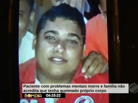 Fam Lia De Jovem Que Morreu Queimado Ir Responsabilizar Hospital