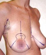 Ulrika Jonsson All Her Nude Pics Porn Pictures Xxx Photos Sex Images Pictoa