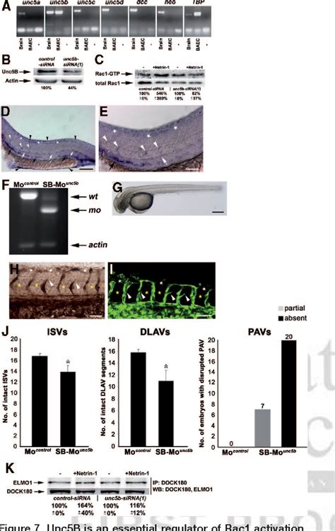 Figure 7 from The Rac1 Regulator ELMO1 Controls Vascular Morphogenesis ... 