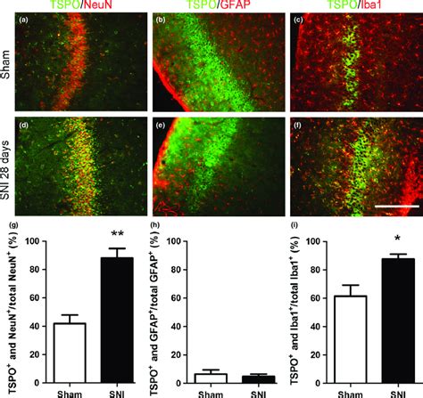 Cellular Distribution Of Translocator Protein TSPO In The