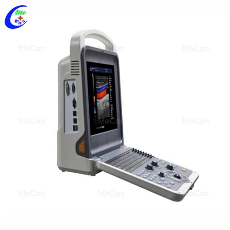 Quality Portable Full Digital Color Doppler Ultrasound Diagnostic