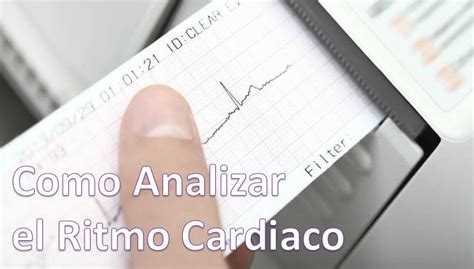 Electrocardiograma Cerebromedico