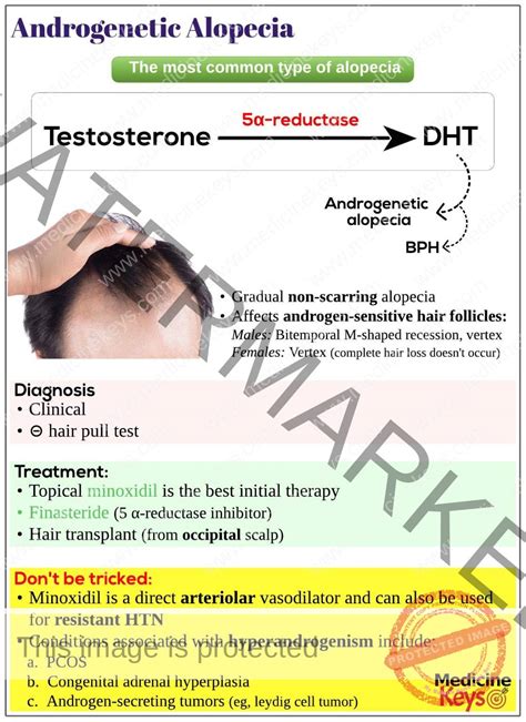 Androgenetic Alopecia Medicine Keys For MRCPs