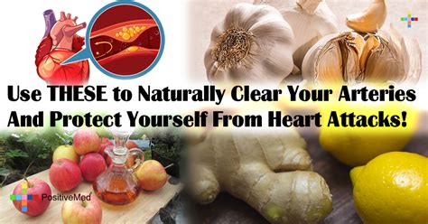 Use These To Naturally Clear Your Arteries And Protect Yourself From