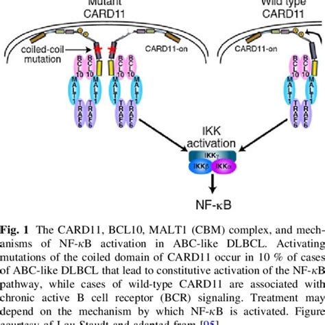 (PDF) Diffuse large B cell lymphoma: Molecular targeted therapy