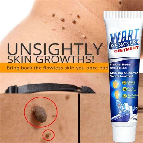 WartsOff Crema instantánea para eliminar imperfecciones extracto