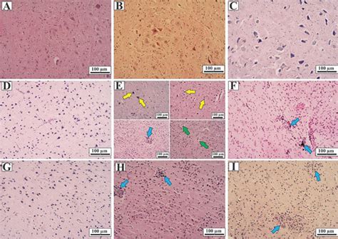 Hippocampus sections in control and treatments groups (n=3). H&E ... 
