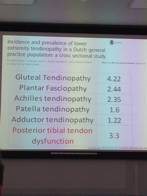 Shockwave Therapy for Plantar Fasciitis
