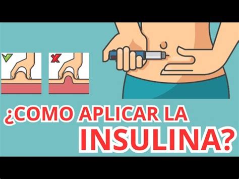 CÓMO APLICAR INSULINA CORRECTAMENTE PASO A PASO YouTube