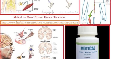 Herbal Care Products: Motor Neuron Disease Treatment by Herbal Products