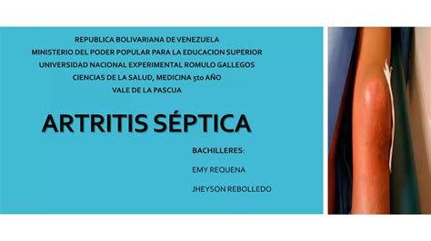 Artritis Septica Ultimo Pptx