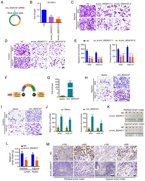 Gcmscderived Circ Promotes Gastric Cancer Cell Lymphatic