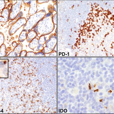 Controls For The Immunohistochemical Ihc Reactions Pd L A