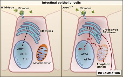 Unresolved ER Stress Inflames the Intestine: Cell