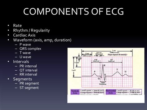 Systematic Ecg Interpretation