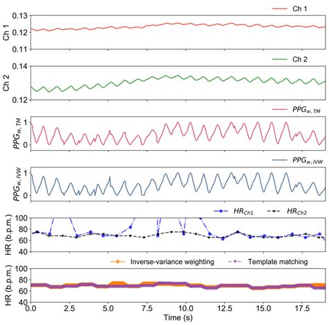 Heart Rate Detection Using TM And IVW Algorithms From The Printed