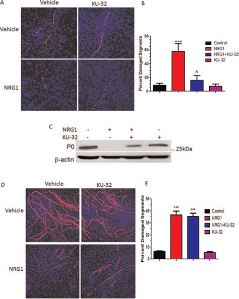 Induction Of Heat Shock Protein 70 Hsp70 Prevents Neuregulin Induced