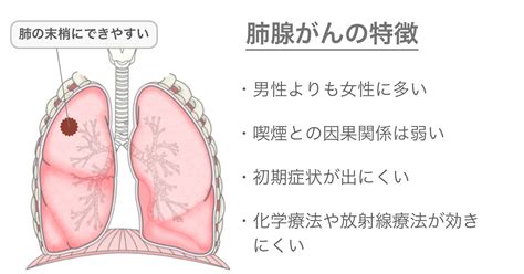 医師監修・作成 肺腺がんとは？原因、症状、検査、治療について Medleyメドレー