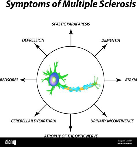 Symptoms Of Multiple Sclerosis The Destruction Of The Myelin Sheath On