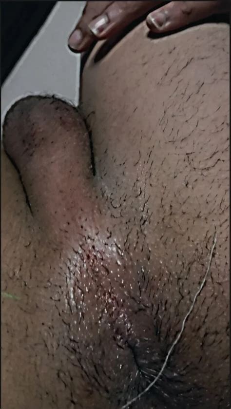 Tarma Zwiwna 5 Nude Pics XHamster