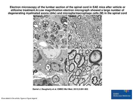 Electron Microscopy Of The Lumbar Section Of The Spinal Cord In EAE