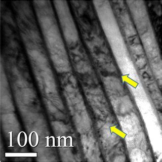 Tem Micrographs Showing Dislocation Tangles In A Steel Wire Drawn With