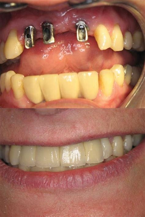 Dentiks Latvia - Dentist in Riga - WhatClinic