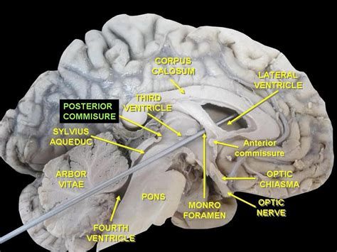 Brain Anatomy Human Anatomy And Physiology Medical Anatomy Circle Of