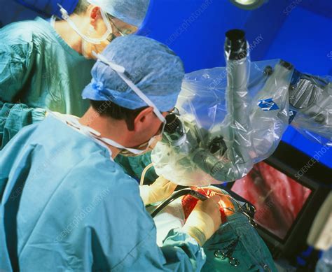 Surgeon Conducting Cochlear Implant Ear Surgery Stock Image M572