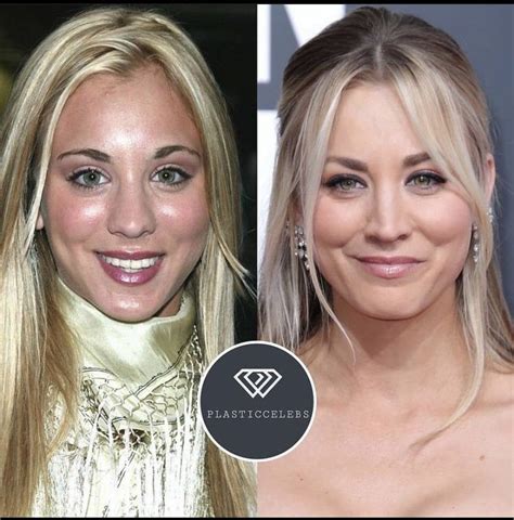 Kaley Cuoco Before After